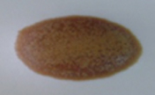 BETAplast™ Vertical and higher absorption capacity